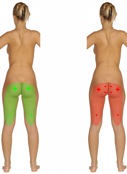 File:Pelvis Directing - Buttocks.png